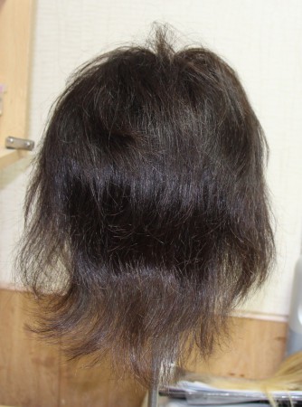 затылочная часть